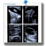 Portable Ultrasound Machine For Horse Vet Use Only