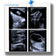 Portable Ultrasound Machine For Horse Vet Use Only
